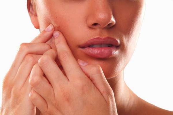Voksen hormonel acne: årsager og behandling