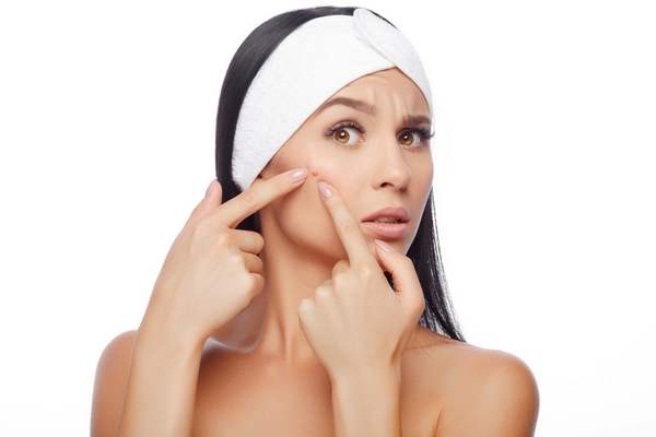 Eksterne årsager til Acne
